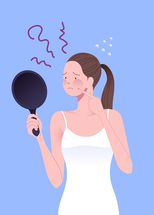 Skin lesions that look like pimples can be acne-like rashes and should not be squeezed carelessly. Excessive squeezing by hand can damage the skin and cause pigmentation (Photo=Clip Art Korea).