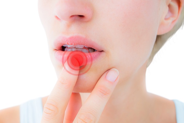 립 플럼퍼에는 입술을 부풀리기 위해 피부자극유발성분을 넣는 경우가 많아 부작용이 생겼다면 즉각 사용을 중단해야 한다(사진=클립아트코리아).