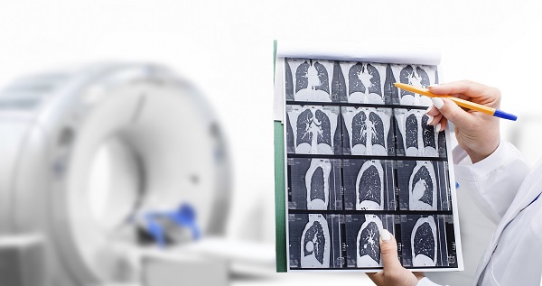 肺癌从诊断到治疗、康复等全过程中，由多种诊疗科进行协诊，带动患者恢复（照片=Clip Art Korea）。