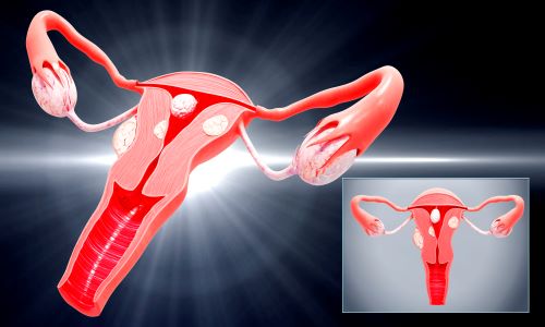 젊은층 자궁내막암환자가 증가하고 있다. 자궁내막암 대표 증상으로는 자궁 또는 질출혈, 복부, 골반 등의 통증이 있다(사진=클립아트코리아).