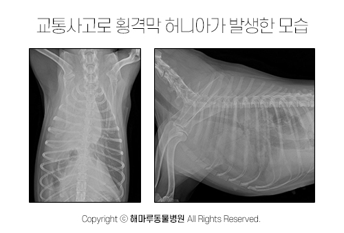 교통사고로 간, 위, 소장 등 복강 장기가 우측 흉강으로 탈출된 횡격막 허니아 환자의 모습 (좌)엑스레이 복배상 사진 (우)엑스레이 외측상 사진