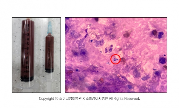(좌) 초음파유도하 간농양 배액 (우)도말에서 보이는 세균(빨간 원)